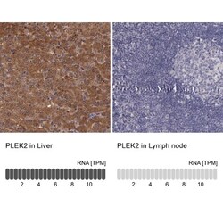Pleckstrin-2 Antibody, Novus Biologicals 0.1mL; Unlabeled:Antibodies, Polyclonal